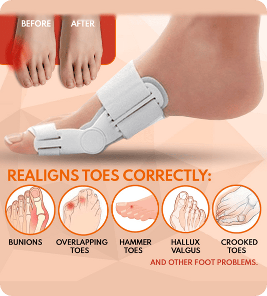 ERGO Bunion Corrector to Relieve, Align, Restore